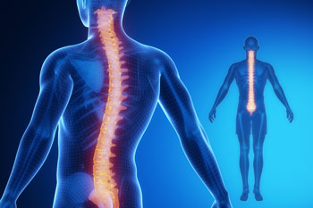 Spinal Cord Injury